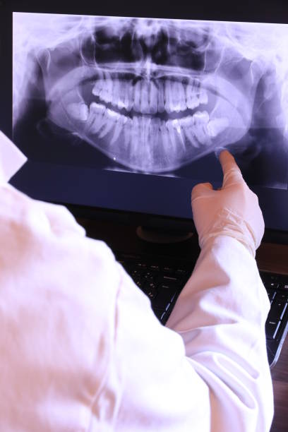 Best Dentist for Tooth Abscess  in Orinda, CA